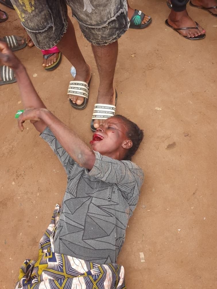 From ‘no sales’ to hospital bed: Benue trader allegedly brutalised over levy